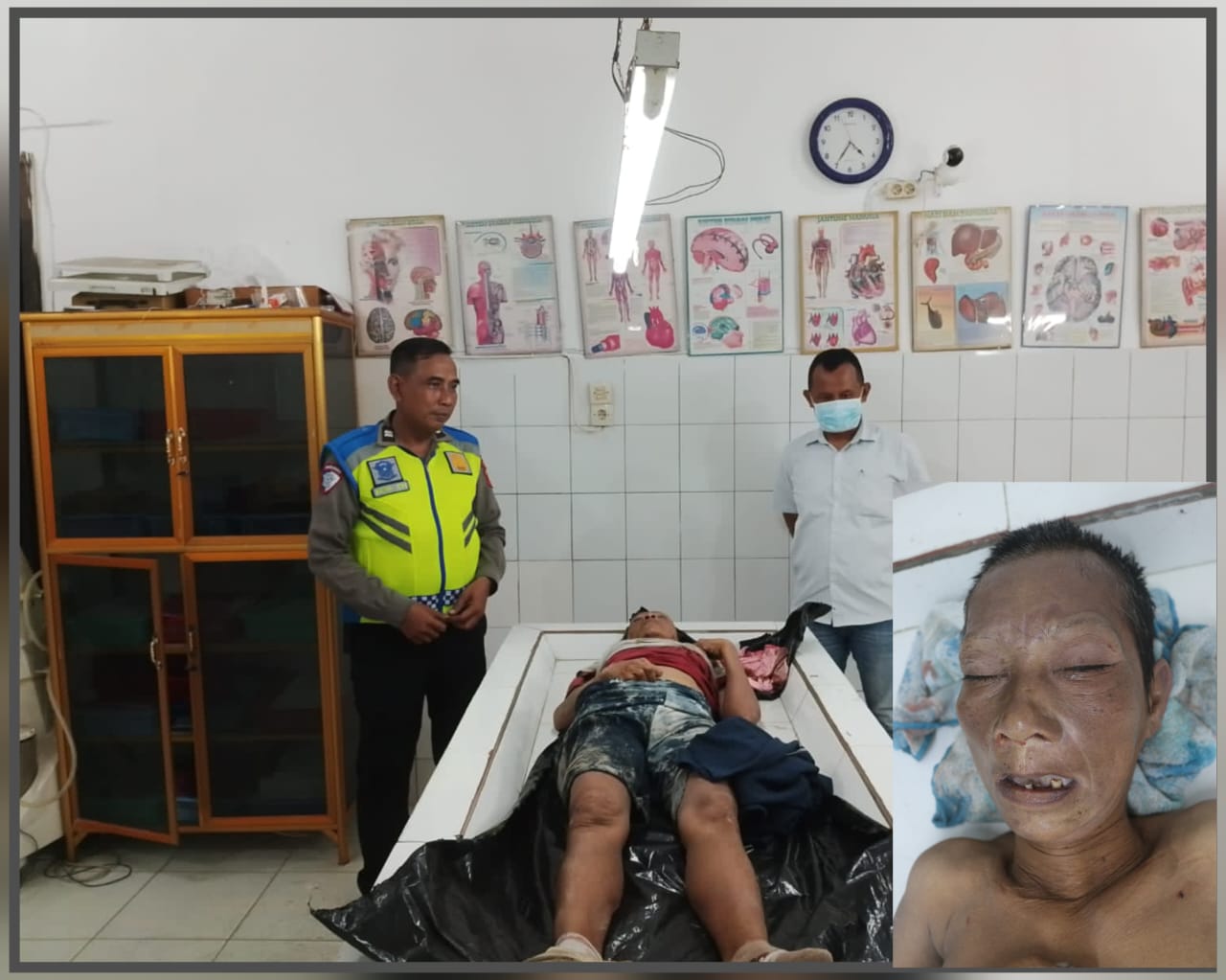 Keluarga Siapa Ini, Ditemukan Wanita Tanpa Identitas Korban Tabrak Lari di Jalan Umum Nagori Dolok Kahean, Keluarga Siapa Ini, Ditemukan Wanita Tanpa Identitas Korban Tabrak Lari di Jalan Umum Nagori Dolok Kahean,