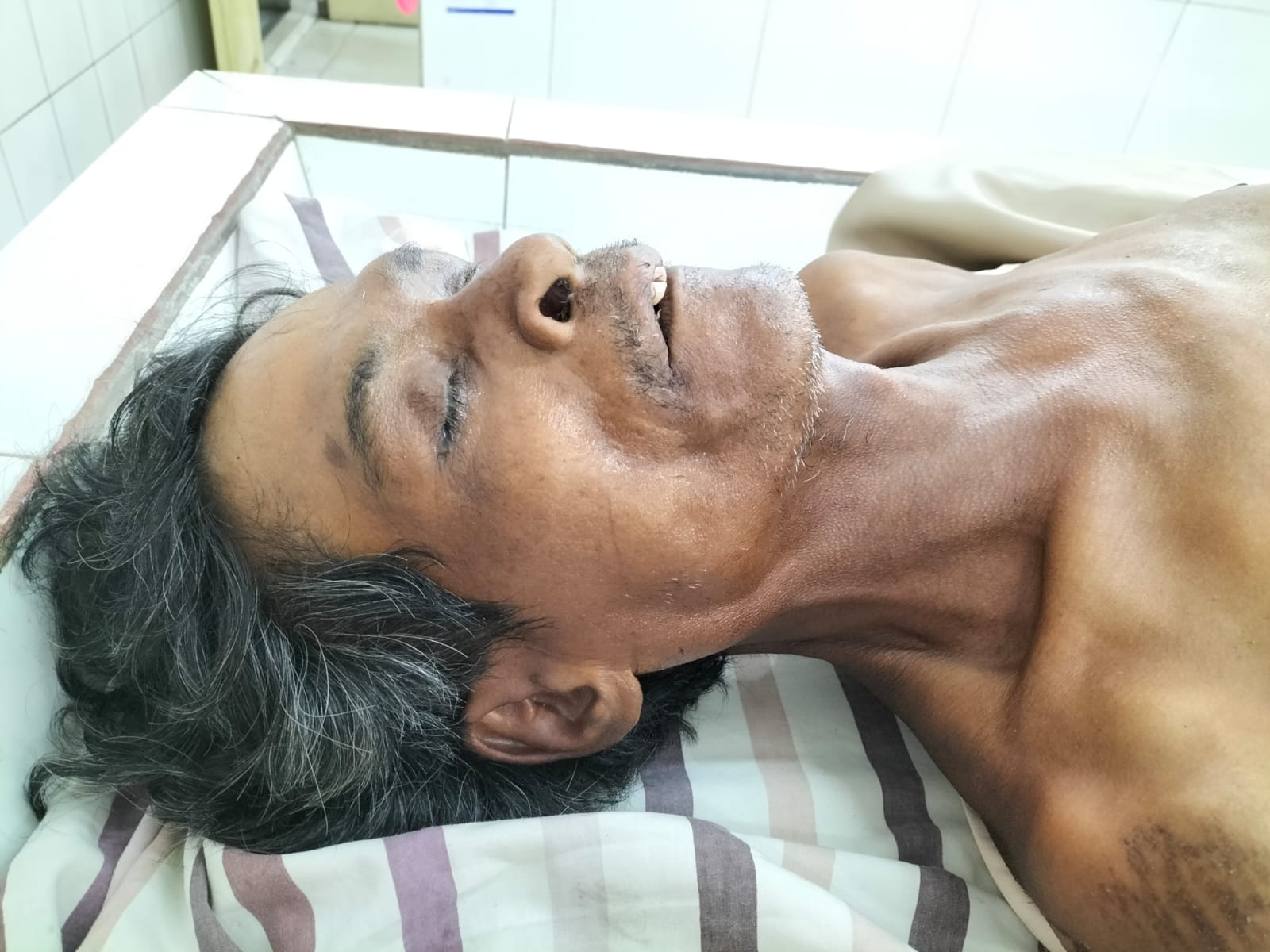 Polres Simalungun Cari Keluarga Korban Meninggal Laka Lantas di RSUD Djasamen Saragih Siantar Polres Simalungun Cari Keluarga Korban Meninggal Laka Lantas di RSUD Djasamen Saragih Siantar