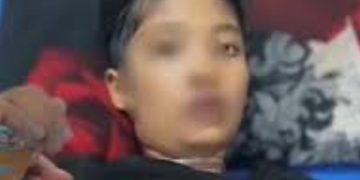 Disiksa Ibu Tiri, Bocah 12 Tahun Sukabumi Meninggal Dunia dengan Luka Lebam dan Bakar