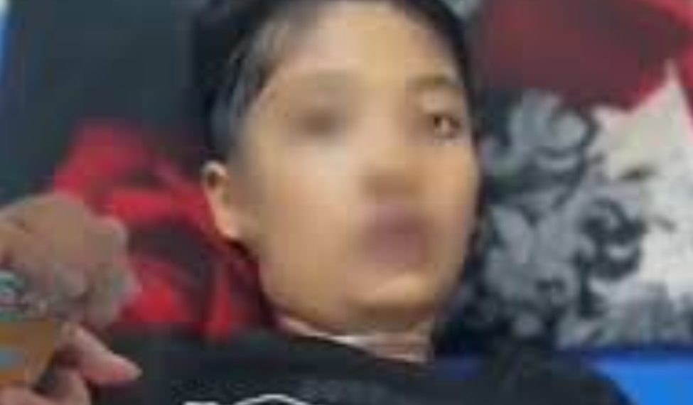 Disiksa Ibu Tiri, Bocah 12 Tahun Sukabumi Meninggal Dunia dengan Luka Lebam dan Bakar