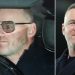 Wayne Rooney menjalani operasi hidung setelah dua kali mengalami patah tulang selama berkarier sebagai pesepakbola dan baru menjalani prosedur tersebut tahun ini.
