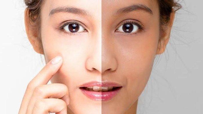 Kulit Kusam Bikin Wajah Terlihat Lelah? Ini Cara Mengatasinya