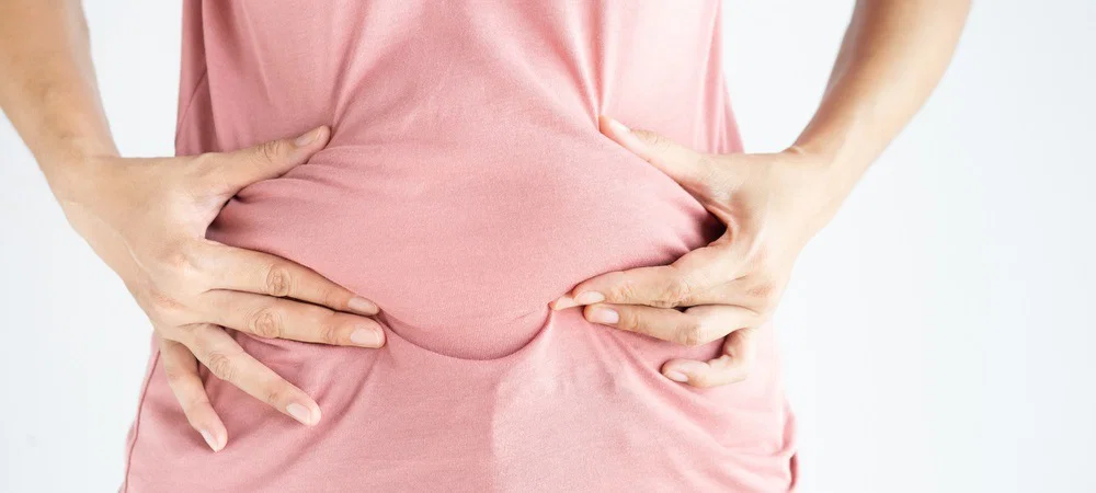 5 Cara Mudah Mengecilkan Perut Buncit, Sehat dan Efektif