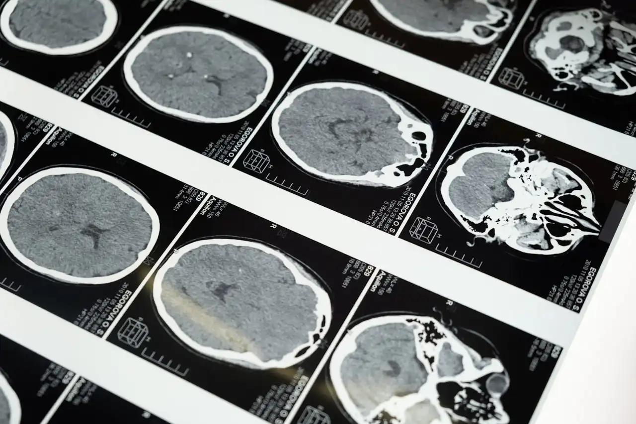 Are You Accidentally Sabotaging Your Brain? Unpacking the Habits That Do Real Damage