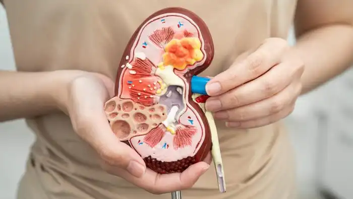 Waspadai Makanan Enak Ini Ternyata Memaksa Ginjal Bekerja Keras