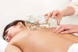 Tips Menghilangkan Pegal dengan Bekam: Aman dan Menyehatkan