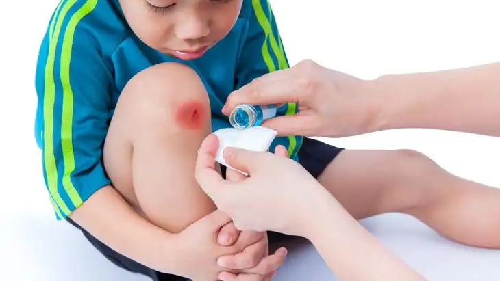 Fakta Medis Membersihkan Luka Hanya Menggunakan Air Mengalir