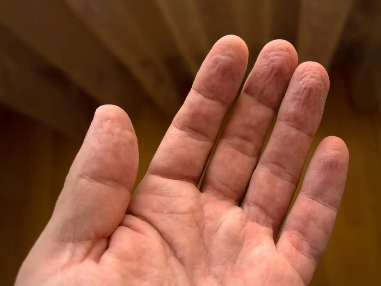 Jari Berkerut Seperti Kismis Setelah Mandi? Ternyata Ini Alasannya