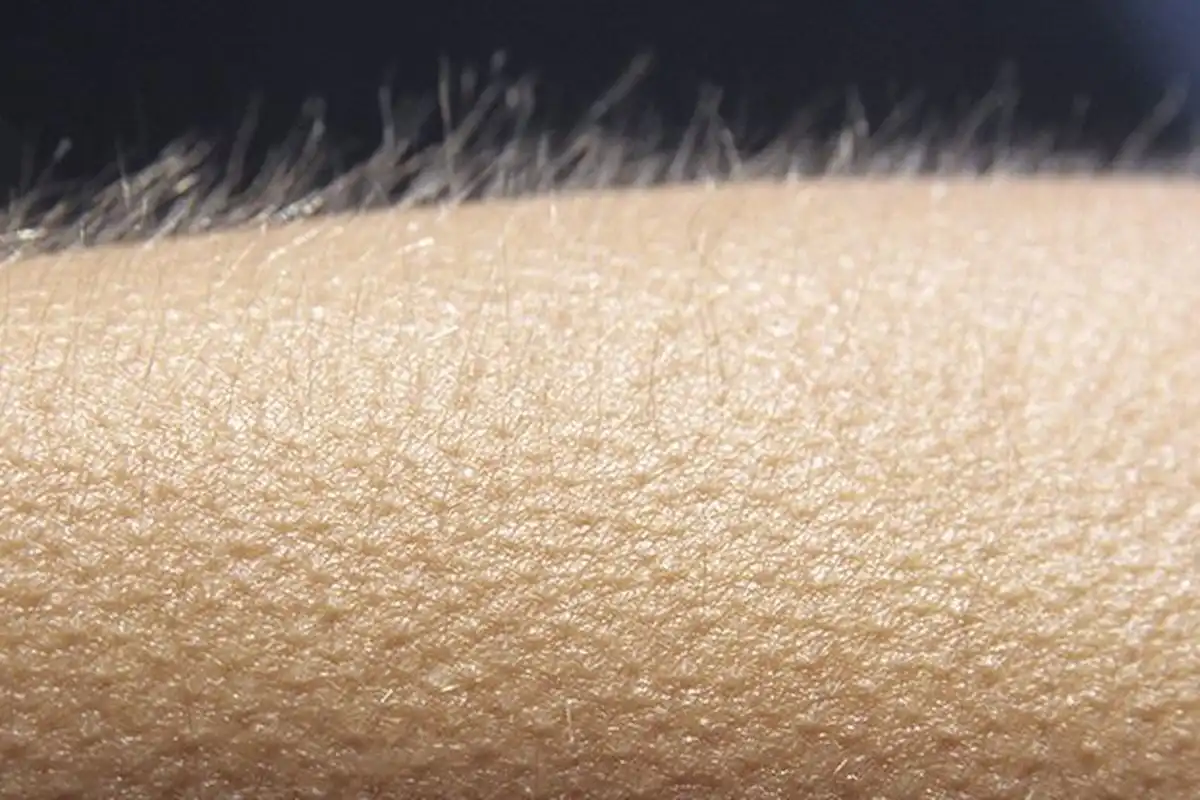 Kenapa Bulu Kuduk Berdiri Tegak? Fakta Menarik di Balik Merinding