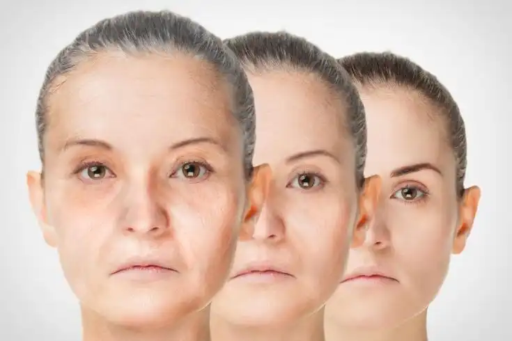 Kenapa Kita Mulai Kepikiran Anti-Aging di Umur Segini? Ini Deretan Vitamin Anti-Aging Gen Z Dijamin Ampuh!