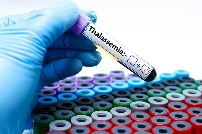Alasan Medis Wajib Skrining Thalassemia Sebelum Menikah dan Hamil