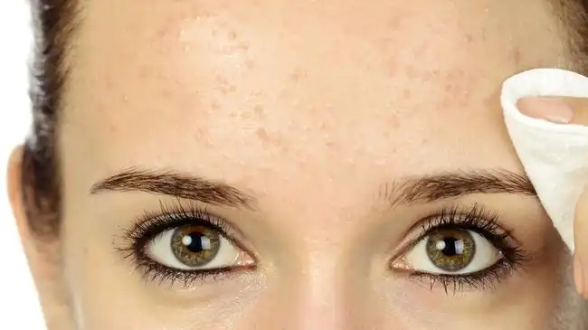 Wajah Terkena Abu Vulkanik? Begini Cara Aman Membersihkan Makeup