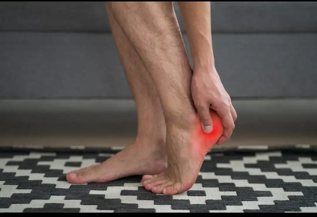 Plantar Fasciitis: Penyebab Umum Nyeri di Tumit Kaki