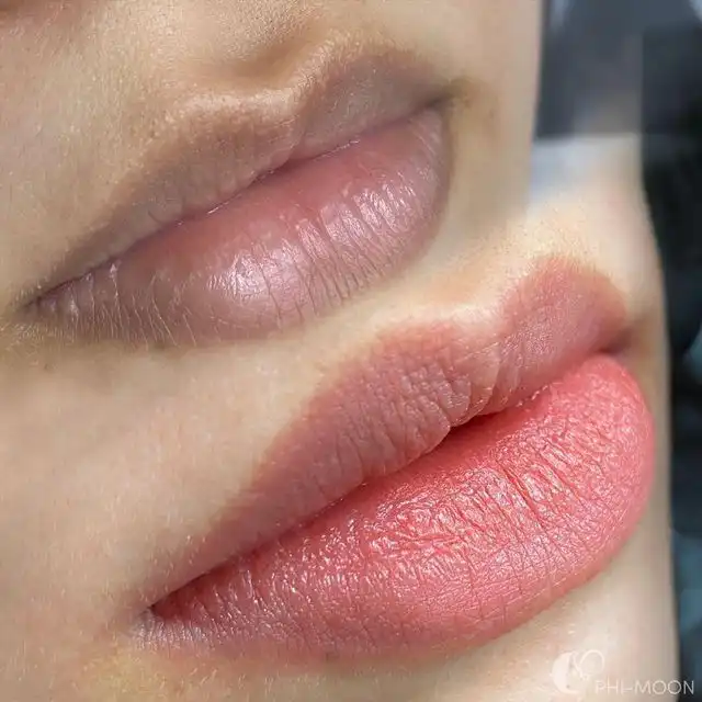 Punya Bibir Gelap Bikin Kurang Percaya Diri? Ini Cara Alami Mencerahkannya dengan Mudah di Rumah