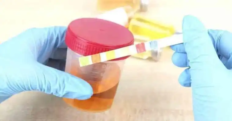 Jangan Diabaikan! Ini Arti Warna Urine dan Mana yang Masih Tergolong Aman