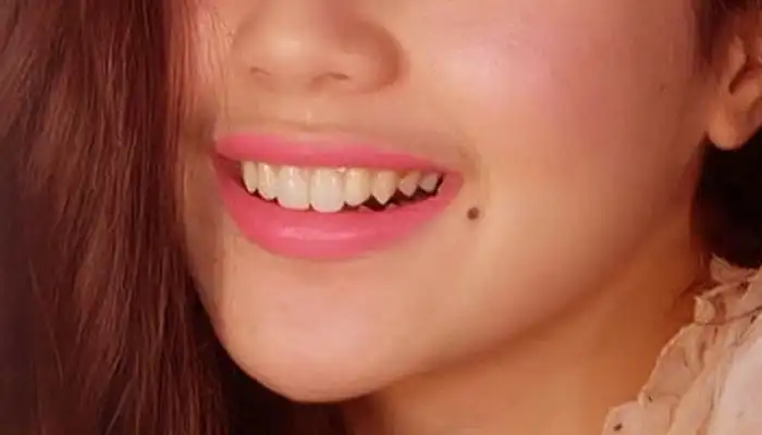 Mitos atau Fakta, Tahi Lalat di Bibir Menandakan Orang Cerewet? Ini Penjelasannya