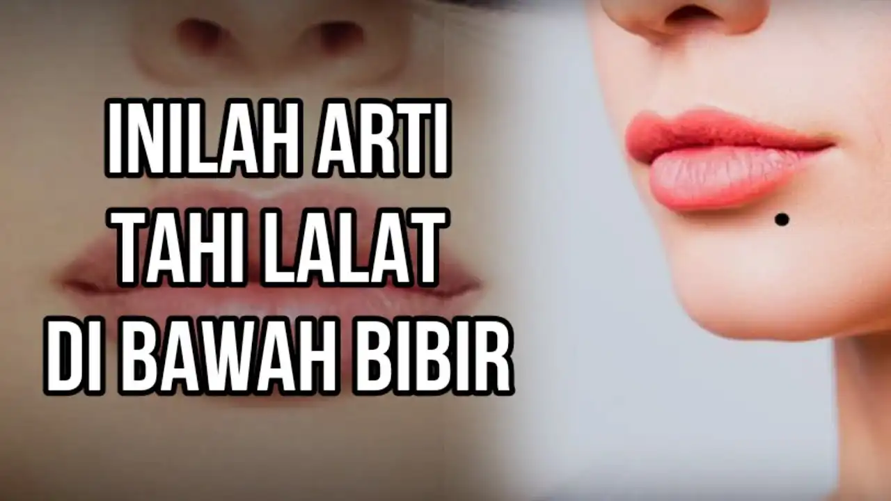 Tahi Lalat di Bibir Sering Dianggap Punya Arti Tertentu, Ini Penjelasan dari Sisi Kesehatan dan Fakta Menariknya