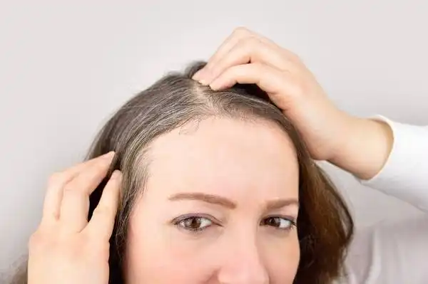 Rambut Beruban Lebih Cepat, Apa Penyebabnya?
