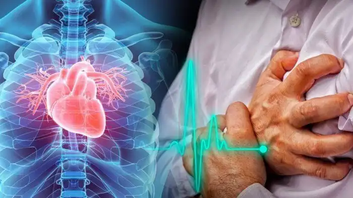 Kebiasaan Sepele yang Bisa Merusak Kesehatan Jantung