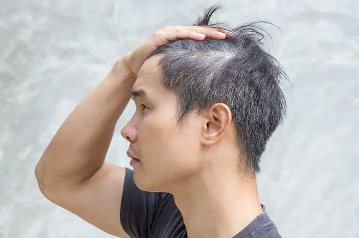 Padahal umur masih muda tapi udah ubanan itu normal gak sih?