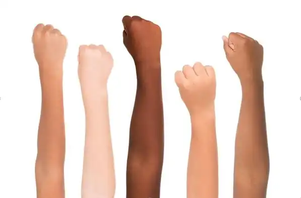 Perbedaan Warna Kulit Manusia: Keindahan dalam Keberagaman dan Perspektif Ilmiah