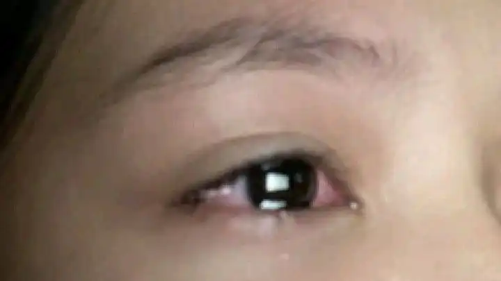 Mengapa Mata Bisa Terlihat Berkaca-kaca saat Menahan Emosi?