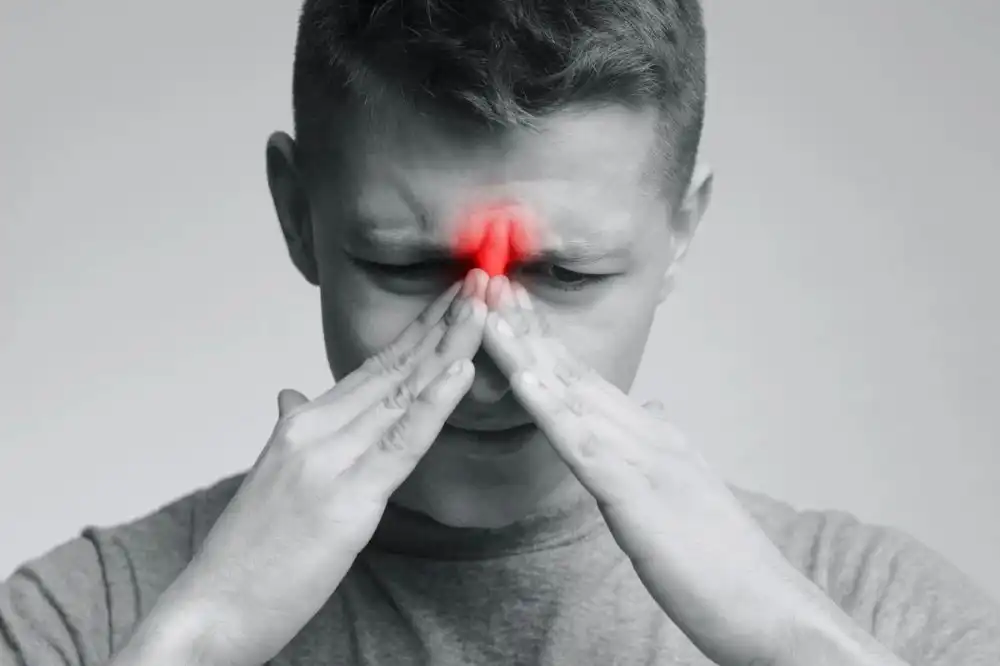 Mengenal Sinusitis: Ciri-Ciri, Penyebab, dan Cara Membedakan Akut vs Kronis