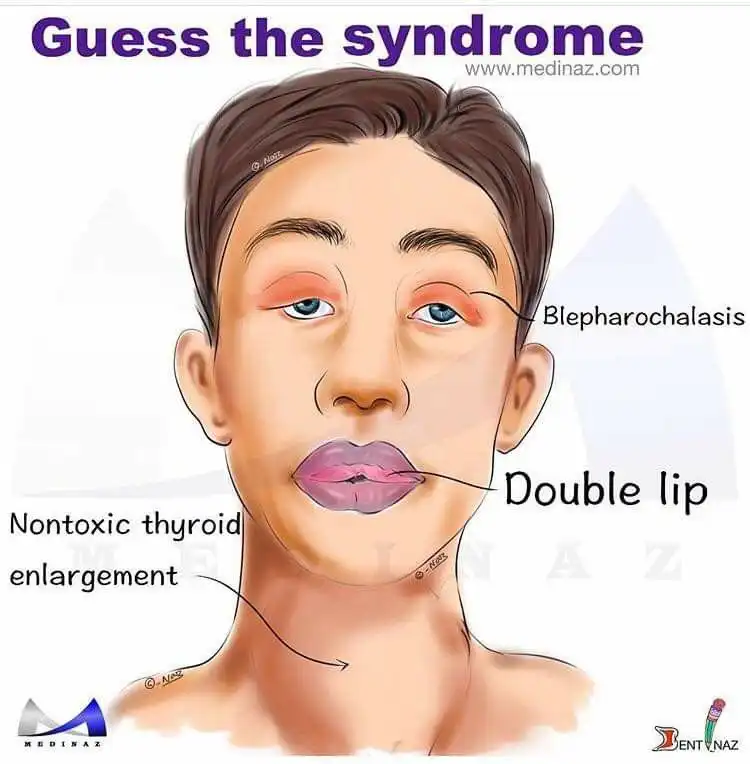 Antara Imposter dan Main Character: Fenomena "Manusia Syndrome" di Era Label Psikologi Populer