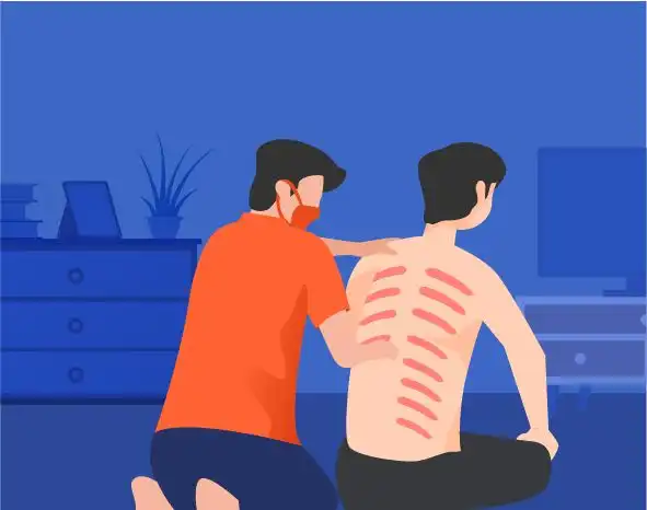 Kerokan Sering Dipilih Saat Badan Terasa Meriang, Begini Efeknya pada Kulit