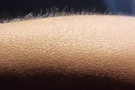 4 Alasan Kenapa Kita Bisa Merinding, dari Kedinginan hingga Emosi