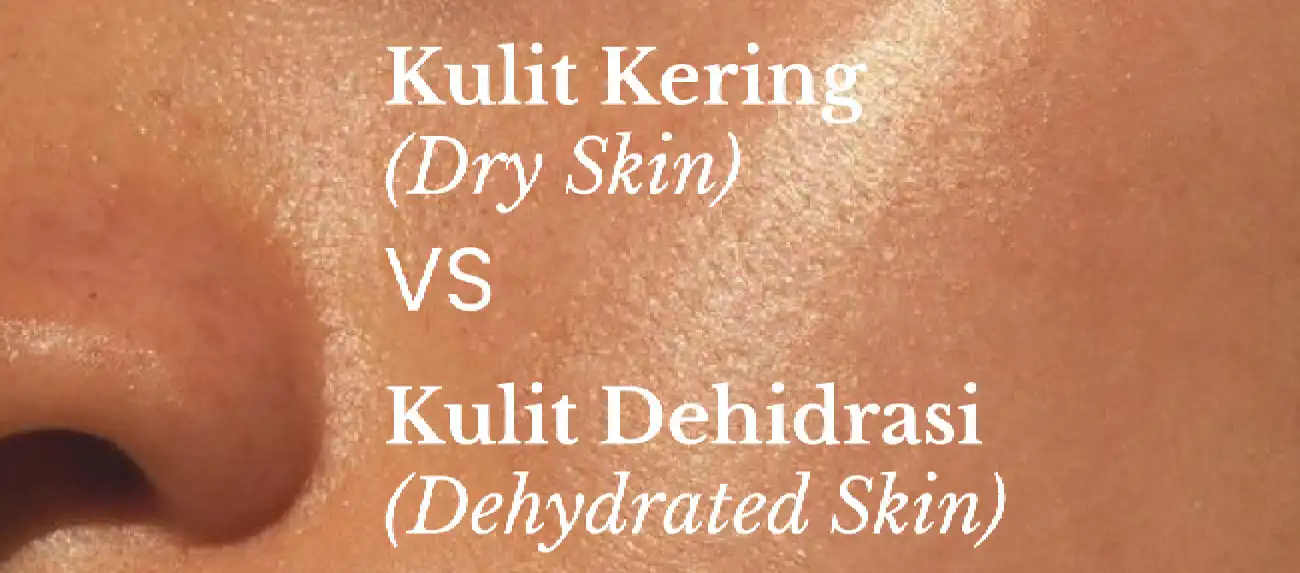Perbedaan Kulit Dehidrasi dan Kulit Kering