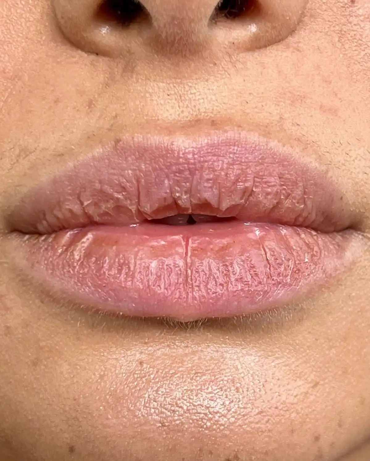 Kenapa Bibir Bisa Tiba-Tiba Berkedut? Ini Penyebab yang Perlu Diketahui