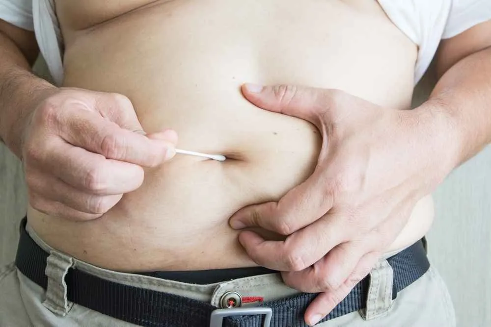 Alasan Ilmiah Mengapa Pusar Jadi Bagian Tubuh Paling Kotor