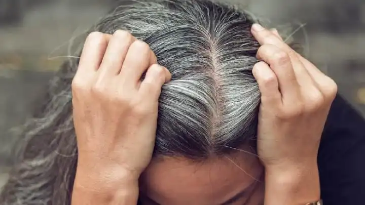 Mengapa Rambut Bisa Beruban?
