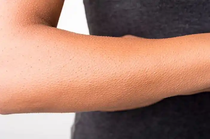 Tiba-Tiba Merinding Tanpa Sebab? Ternyata Ini Penjelasan Ilmiah di Baliknya!