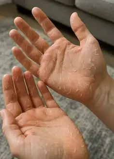Kulit Tangan Kasar Karena Sering Cuci Tangan? Coba Perawatan Sederhana dengan Bahan Alami
