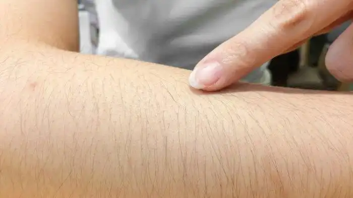 Mengapa Ada Orang yang Memiliki Bulu Tangan dan Kaki yang Tebal? Ini Penjelasannya