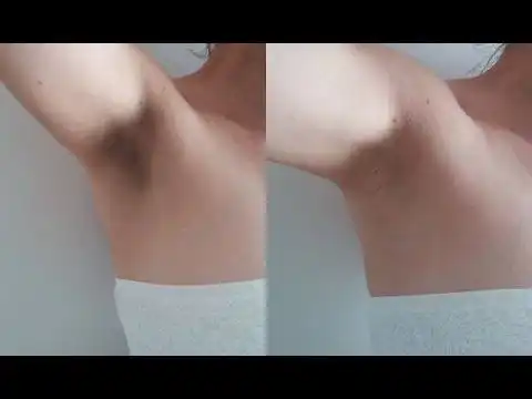5 Cara Ampuh Mencerahkan Ketiak Hitam Secara Alami