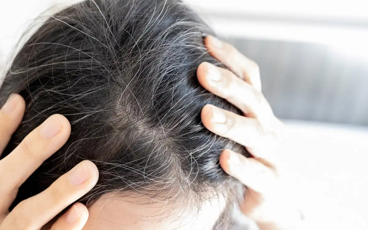 Rambut Beruban Bisa Muncul Lebih Cepat karena Sering Dicabut, Benarkah?
