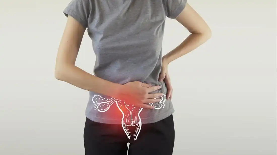 Minum Es Saat Haid, Aman atau Berbahaya? Ini Penjelasan Medisnya