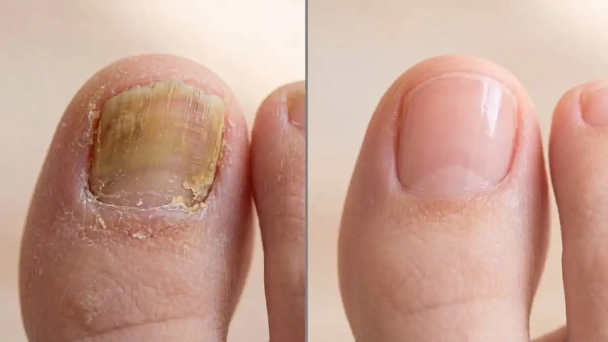 Kenapa Kuku Kaki Bau dan Berwarna Kuning? Simak Penjelasannya