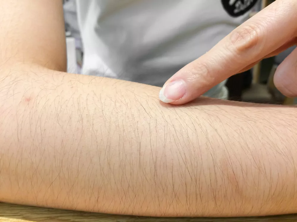 Apa fungsi bulu di tangan dan kaki?