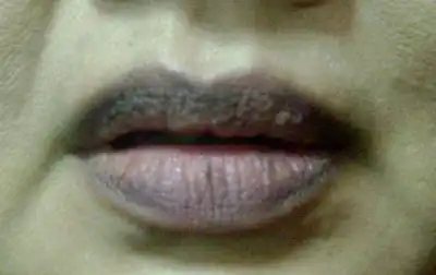 Mengapa Bibir Bisa Menghitam? Ini Penyebab yang Sering Tak Disadari