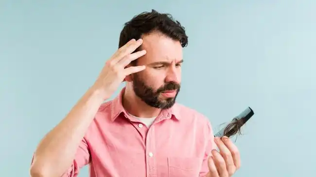Jangan Tunggu Rambut Makin Tipis, Ini 7 Tanda Awal Kebotakan pada Pria