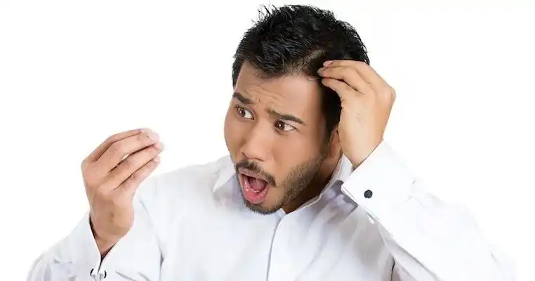 Kenapa Pria Kehilangan 40 Rambut Sehari dan Haruskah Kita Panik?