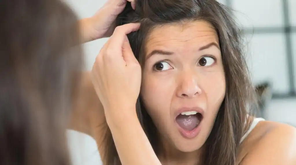 Bukan Faktor Penuaan, Ini Pemicu Uban Muncul di Usia Remaja