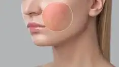 Mengenal Skin Barrier: Fungsi, Penyebab Kerusakan, dan Cara Merawatnya agar Glowing