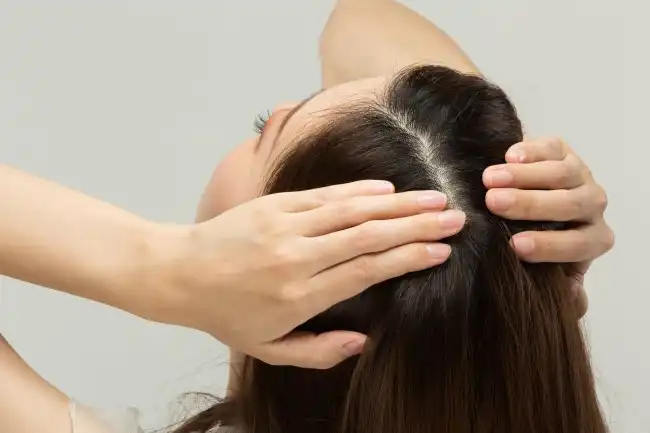 Kulit Kepala Sehat, Rambut Pun Lebih Terawat