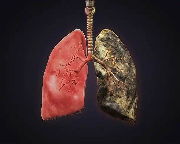 Dari Nikotin hingga Arsenik, Kenali Bahaya Rokok bagi Tubuh