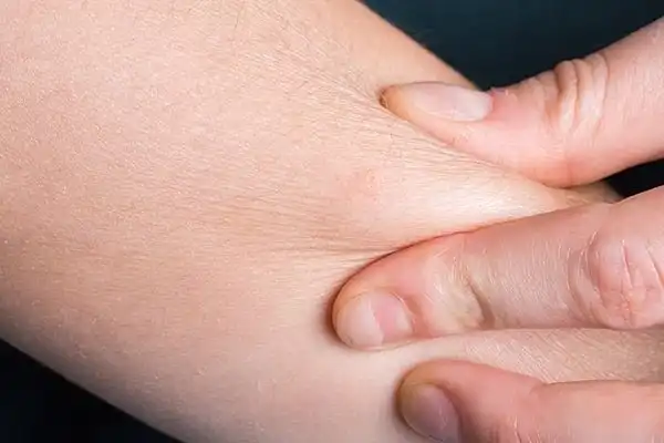 Jangan Abaikan! Kelembapan Kulit Kunci Tampil Percaya Diri